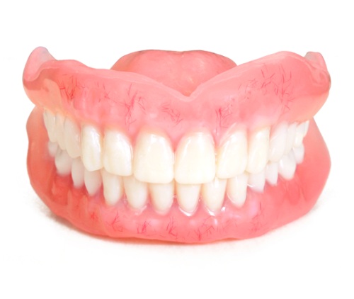 3Dプリントデンチャー